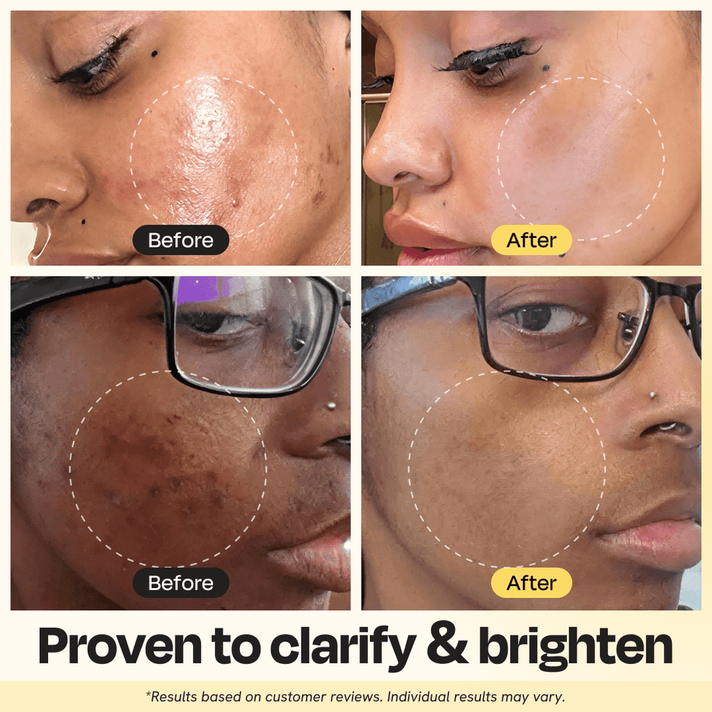 88 Beauty Vitamin C Brightening Clay Mask