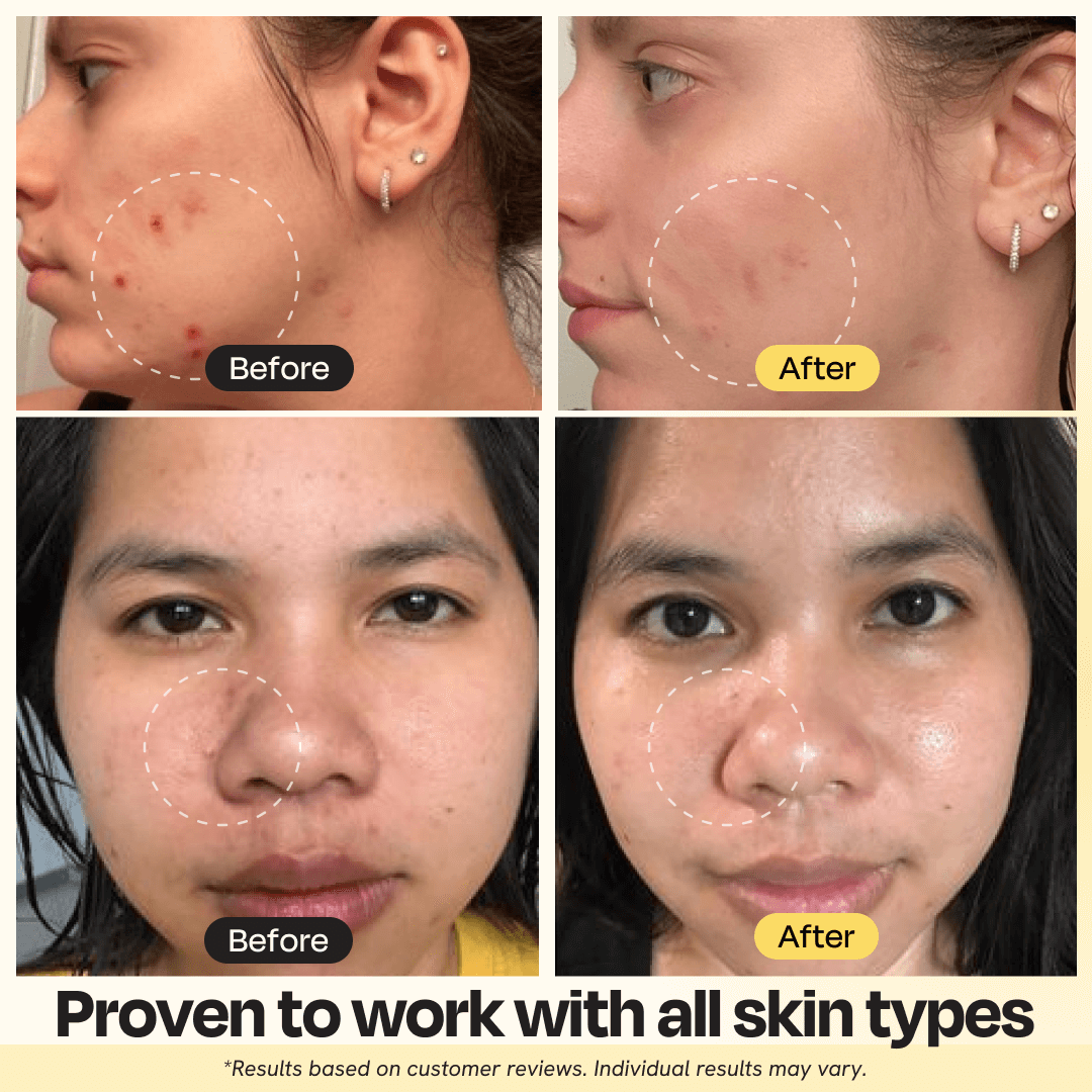 88 Beauty Vitamin C Brightening Clay Mask
